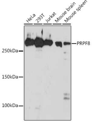 Western Blot: PRPF8 Antibody (4I1Q8) [NBP3-16440]