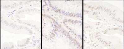 Immunohistochemistry: PRPF8 Antibody [NBP2-22272]