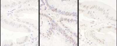 Immunohistochemistry: PRPF8 Antibody [NBP2-22274]