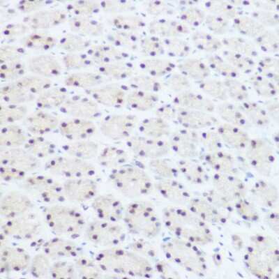 Immunohistochemistry-Paraffin: PRPF8 Antibody - BSA Free [NBP2-93689]