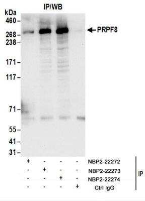 Immunoprecipitation: PRPF8 Antibody [NBP2-22273]