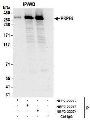 Immunoprecipitation: PRPF8 Antibody [NBP2-22274]