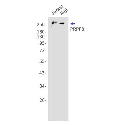 Western Blot: PRPF8 Antibody (S06-1I7) [NBP3-19748]