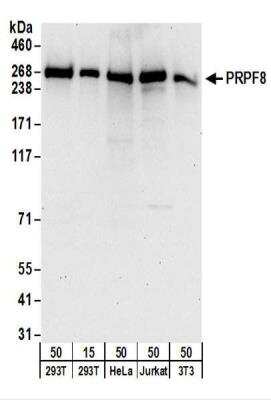 Western Blot: PRPF8 Antibody [NBP2-22272]