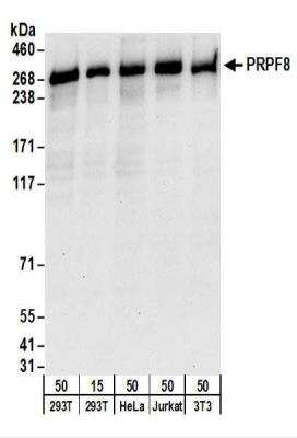 Western Blot: PRPF8 Antibody [NBP2-22273]