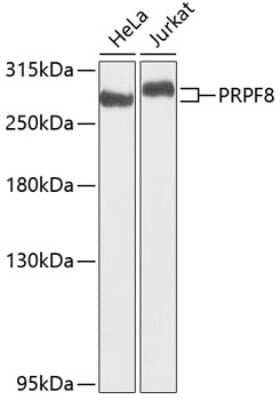 Western Blot: PRPF8 AntibodyBSA Free [NBP2-93689]