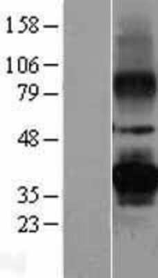 Western Blot: Peripherin 2/PRPH2 Overexpression Lysate [NBL1-14826]