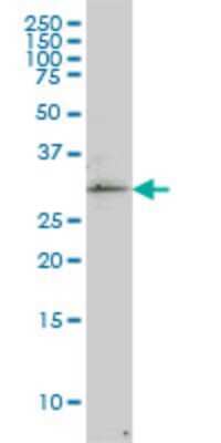 Western Blot: PRPK Antibody (2A9) [H00112858-M02]