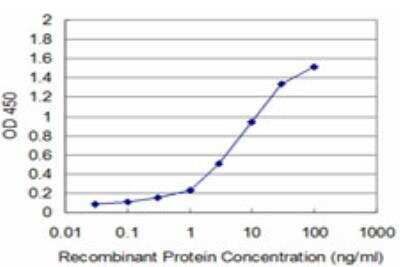 ELISA: PRPK Antibody (2E10) [H00112858-M05]