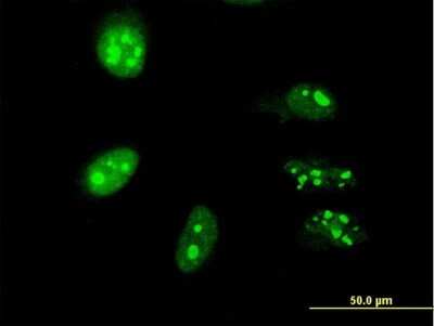 Immunocytochemistry/ Immunofluorescence: PRPK Antibody (2E10) [H00112858-M05]