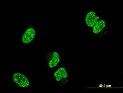 Immunocytochemistry/ Immunofluorescence: PRPK Antibody (2E8) [H00112858-M06]