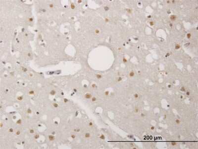 Immunohistochemistry-Paraffin: PRPK Antibody (2E8) [H00112858-M06]