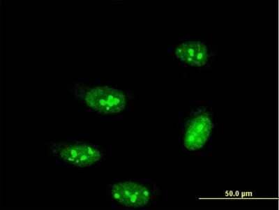 Immunocytochemistry/ Immunofluorescence: PRPK Antibody (3A1) [H00112858-M03]