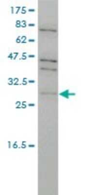 Western Blot: PRPK Antibody (4B9-1H3) [H00112858-M01]