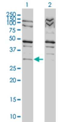 Western Blot: PRPK Antibody (4B9-1H3) [H00112858-M01]