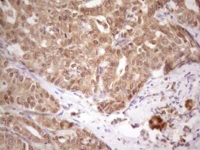 Immunohistochemistry: PRPK Antibody (OTI5B2) [NBP2-46196]
