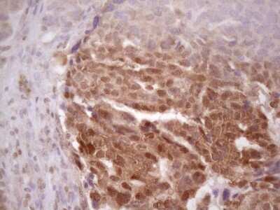 Immunohistochemistry: PRPK Antibody (OTI5B2) [NBP2-46196]