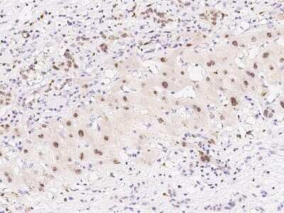 Immunohistochemistry-Paraffin: PRPK Antibody [NBP2-99394]