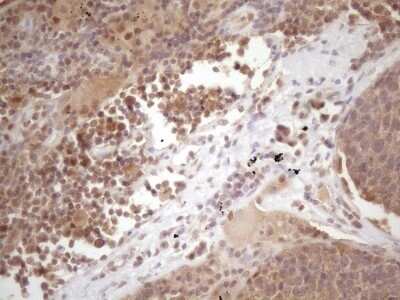 Immunohistochemistry: PRPK Antibody (OTI5B2) - Azide and BSA Free [NBP2-73675]