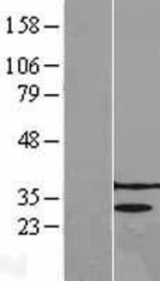 Western Blot: PRPK Overexpression Lysate [NBL1-17207]