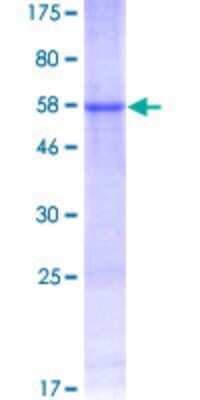 SDS-PAGE: Recombinant Human PRPK GST (N-Term) Protein [H00112858-P01]