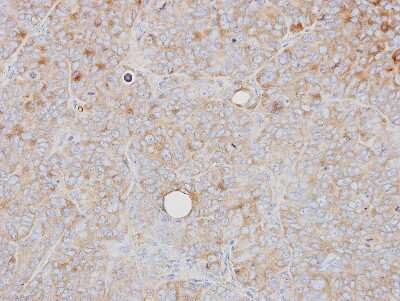 Immunohistochemistry-Paraffin: PRPS1 Antibody [NBP1-31654]