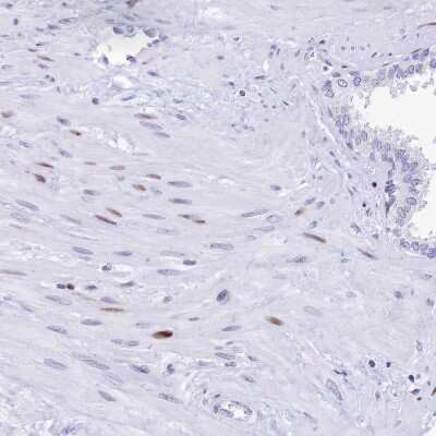 Immunohistochemistry-Paraffin: PRPS1 Antibody [NBP2-13813]