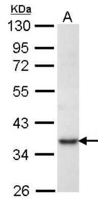 Western Blot: PRPS1 Antibody [NBP1-31654]