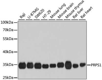 Western Blot: PRPS1 AntibodyBSA Free [NBP2-93816]