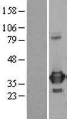 Western Blot: PRPS1 Overexpression Lysate [NBL1-14827]