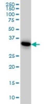 Western Blot: PRPS1L1 Antibody (5E10) [H00221823-M01]