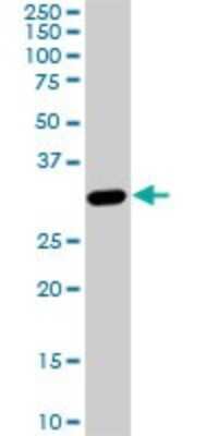 Western Blot: PRPS1L1 Antibody (5E10) [H00221823-M01]