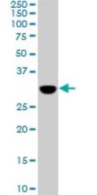 Western Blot: PRPS1L1 Antibody (5E10) [H00221823-M01]