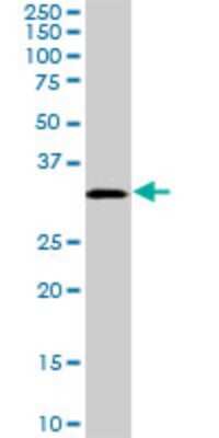 Western Blot: PRPS1L1 Antibody (5E10) [H00221823-M01]