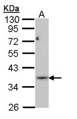 Western Blot: PRPS1L1 Antibody [NBP1-33410]