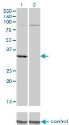 Western Blot: PRPS2 Antibody (4C1) [H00005634-M02]