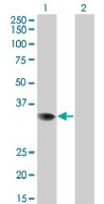 Western Blot: PRPS2 Antibody (4C1) [H00005634-M02]