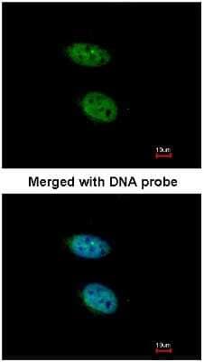 Immunocytochemistry/ Immunofluorescence: PRPS2 Antibody [NBP1-31435]