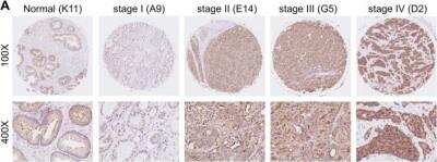 Immunohistochemistry: PRPS2 Antibody [NBP1-31435]
