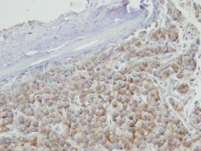 Immunohistochemistry-Paraffin: PRPS2 Antibody [NBP1-31435]