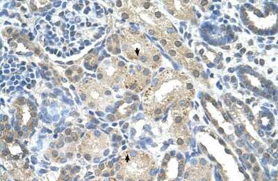 Immunohistochemistry-Paraffin: PRPS2 Antibody [NBP1-57669]