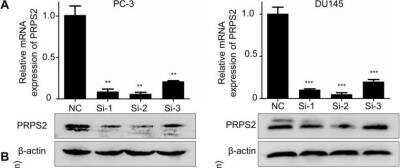 Knockdown Validated: PRPS2 Antibody [NBP1-31435]