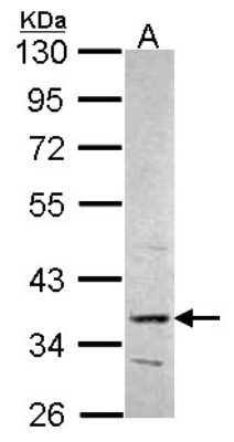 Western Blot: PRPS2 Antibody [NBP1-31435]