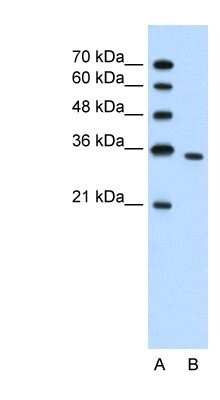 Western Blot: PRPS2 Antibody [NBP1-56666]