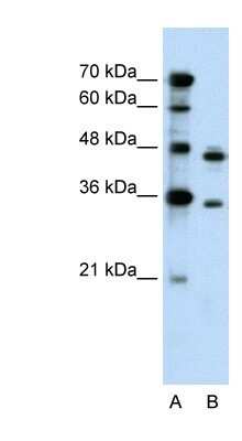 Western Blot: PRPS2 Antibody [NBP1-57669]