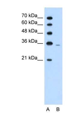 Western Blot: PRPS2 Antibody [NBP1-57670]