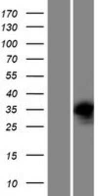 Western Blot: PRPS2 Overexpression Lysate [NBP2-08564]