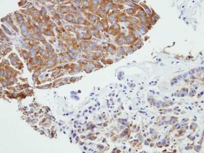 Immunohistochemistry-Paraffin: PRPSAP2 Antibody [NBP1-32630]