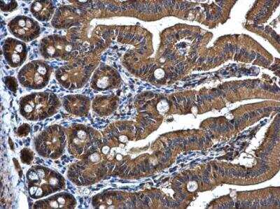 Immunohistochemistry-Paraffin: PRPSAP2 Antibody [NBP1-32630]