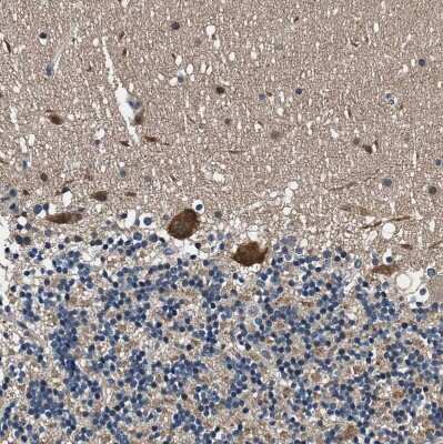 Immunohistochemistry-Paraffin: PRPSAP2 Antibody [NBP1-87341]
